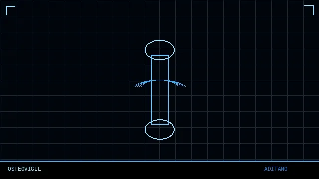 OsteoVigil CT stress-map graphic